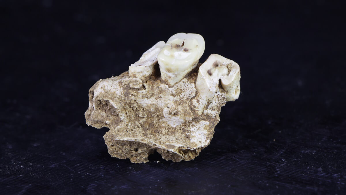three teeth atteacted to what looks like a rock or flat bone