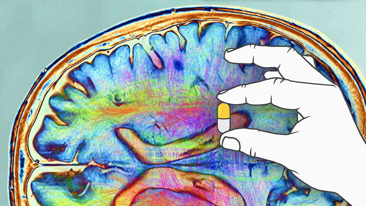 a hand holding a pill in front of a background showing a brain scan