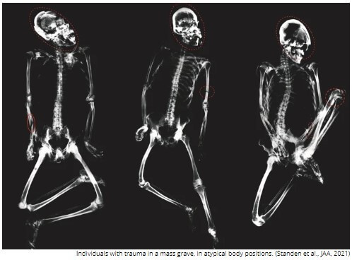 Three skeleton x rays