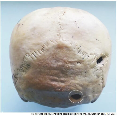 Backof a skull with two holes in it
