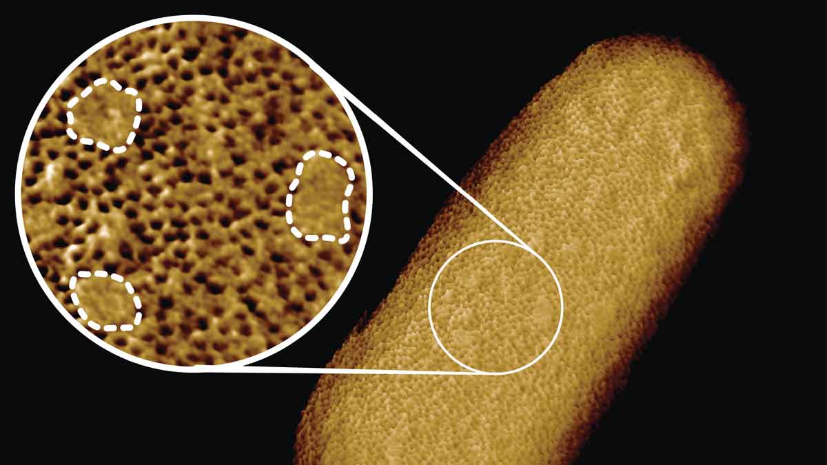 microscopic image of a bacterium