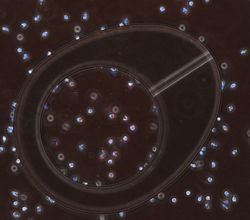 Bacteria and neutrophils under microscope