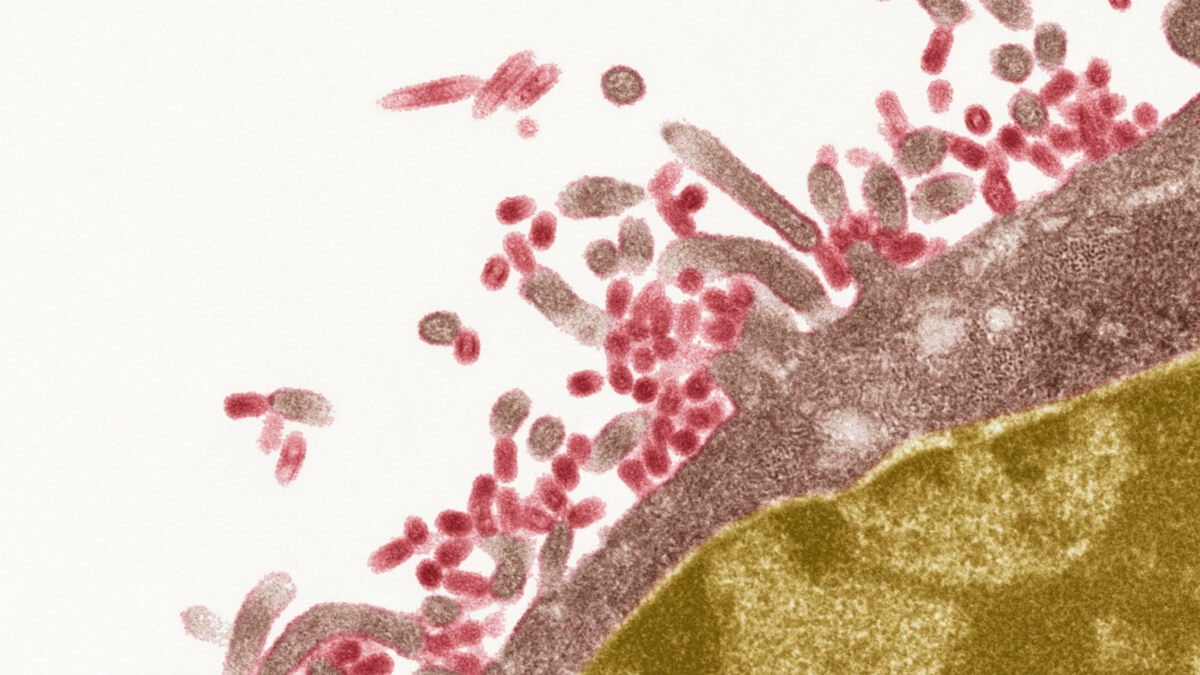Close up photo of a false colour virus