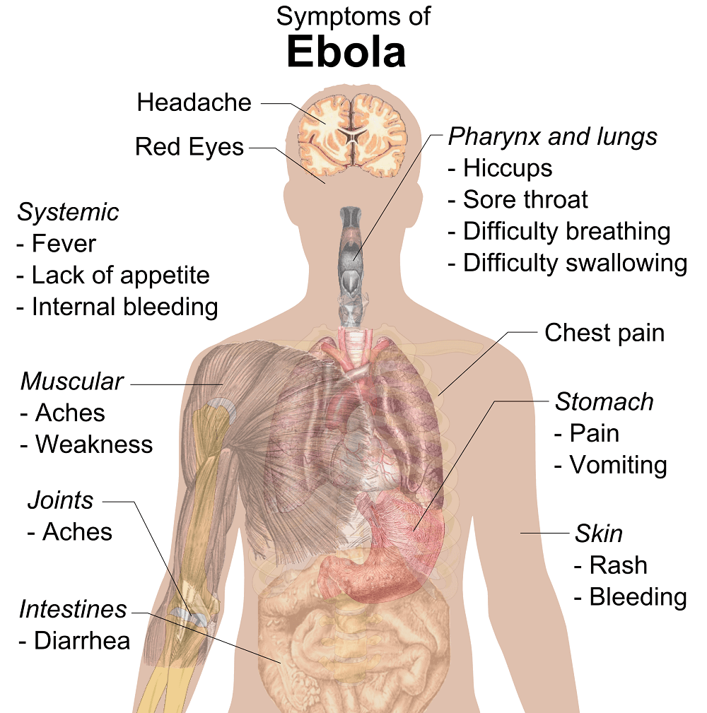 Symptoms of ebola small 1