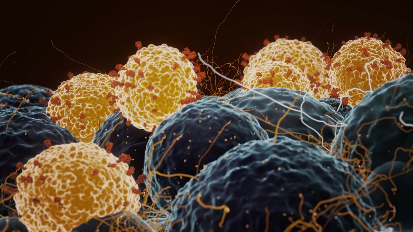 coronavirus particles infecting human cells