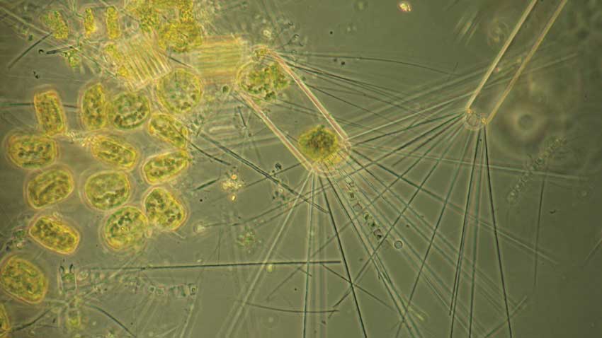 Australian antarctic division phytoplankton micrograph