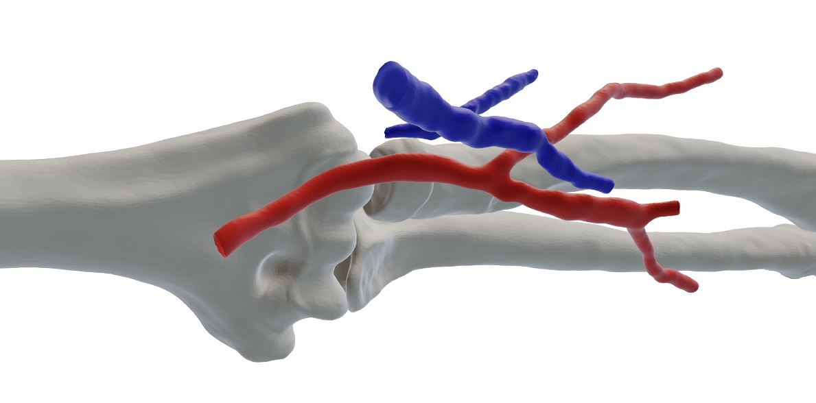 3d rendered image of bone and vein networks