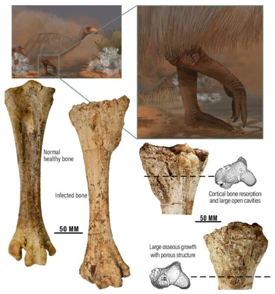 Photographs comparing healthy and infected bones, as well as their location in the body of genyornis newtoni.