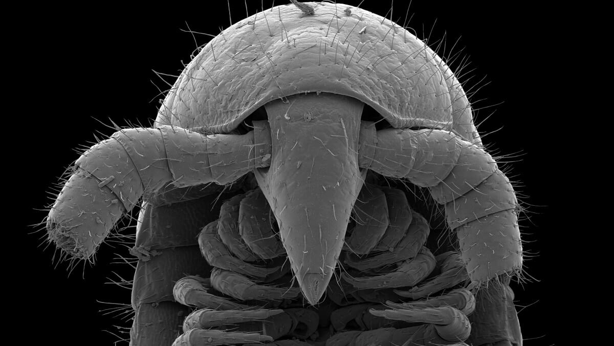 a microscope close up of millipede head