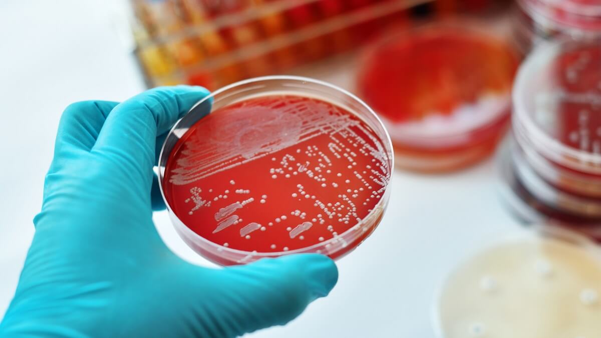 Bacterial culture on agar plate