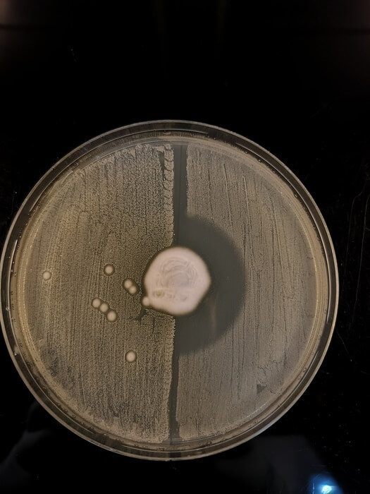 Photo shows fungus trichophyton erinacei growing in the centre of an agar plate streaked with mrsa on the left half and methicillin-susceptible staphylococcus aureus bacteria on the right.