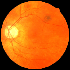 Scan of a human retina. Credit uk biobank
