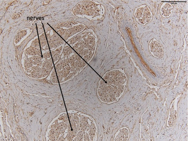 Micrograph of nerves in dolphin clitoris