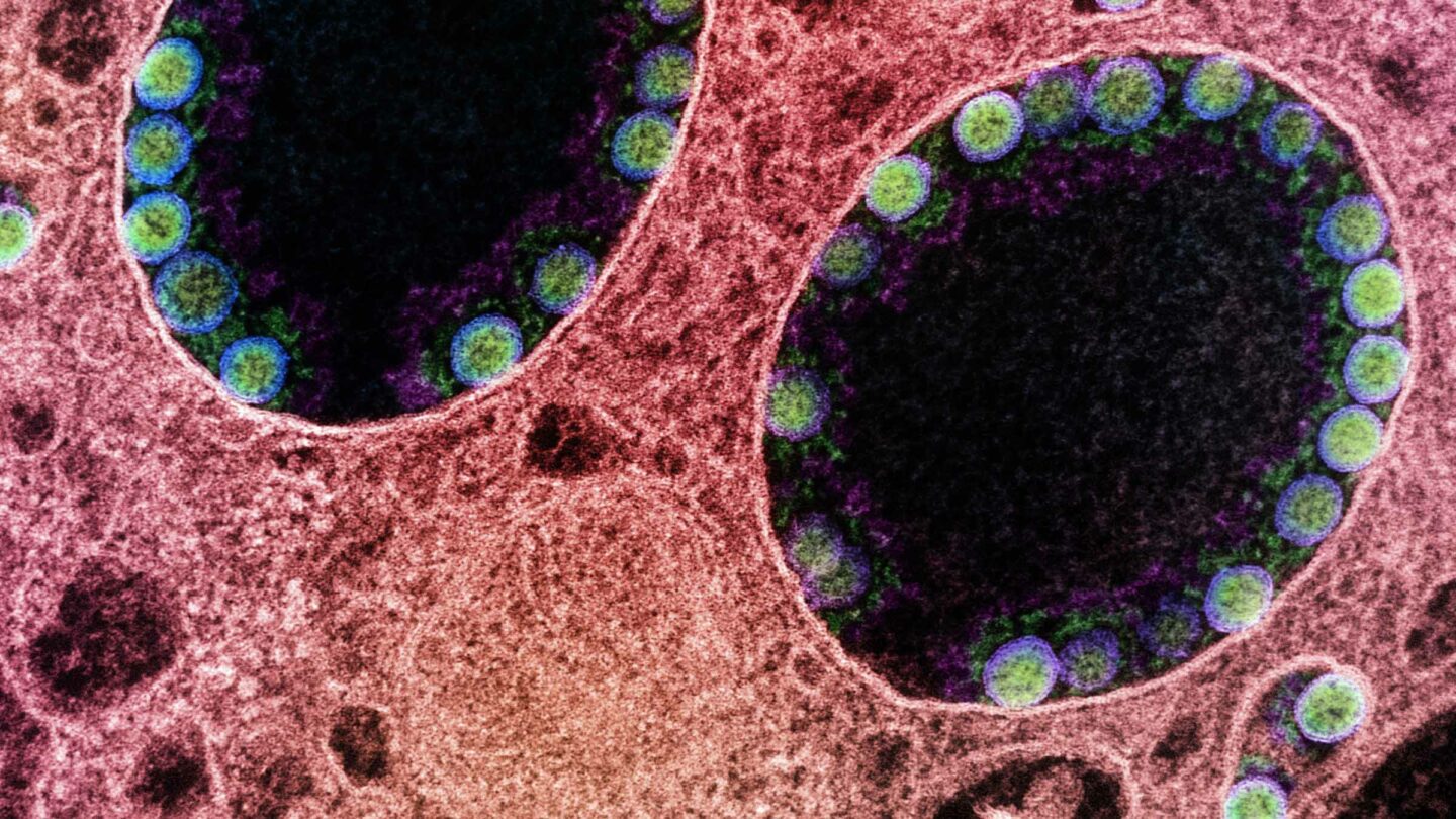 electron micrograph showing a pink host cell that contains endosomes with green sars-cov-2 particles inside