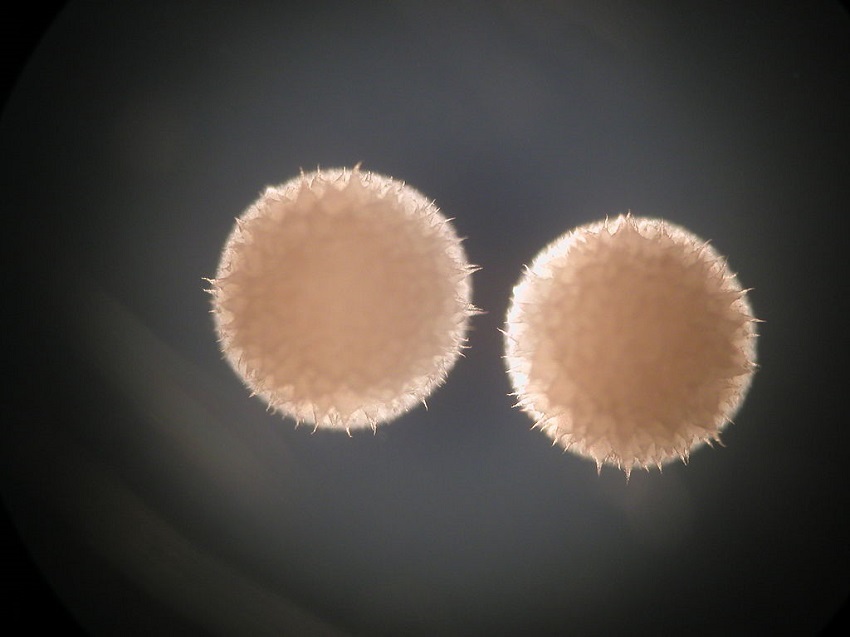 Colonies of streptomyces hygroscopicus on agar plate through microscope. Credit snuupo 850