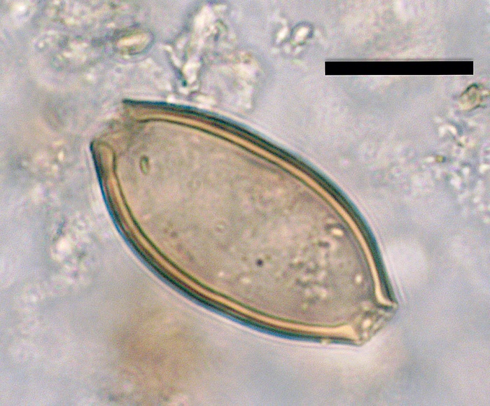 Low res image 3 roman whipworm egg