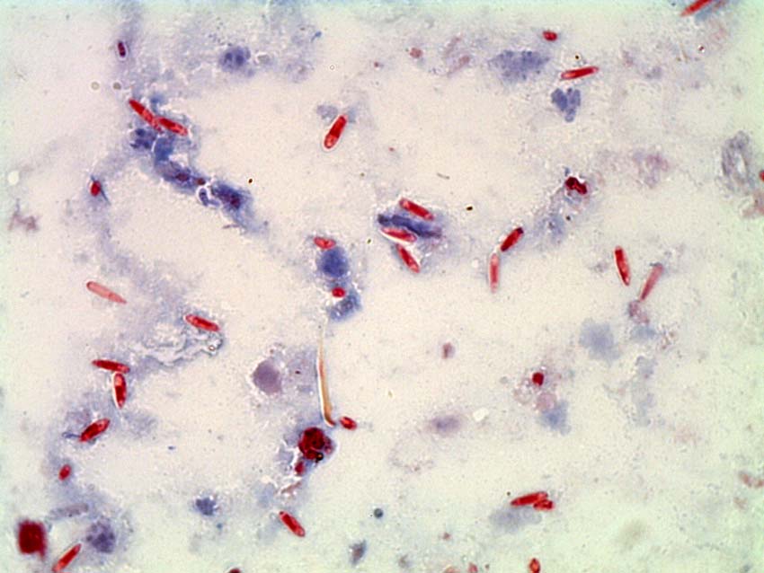 Microscope image showing microsporidia spores