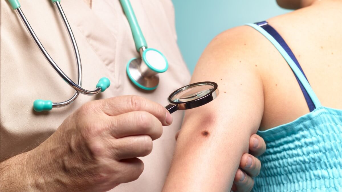 doctor examining mole on woman's arm with magnifying glass