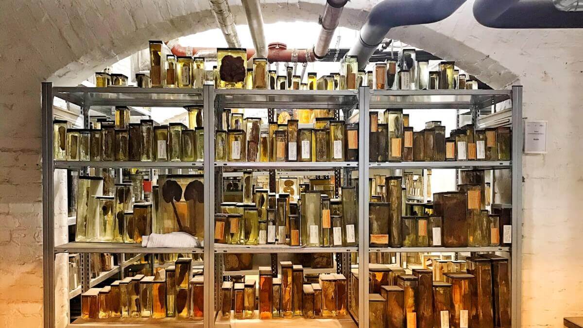basement room containing shelves filled with jars of yellow liquid containing grey anatomical specimens