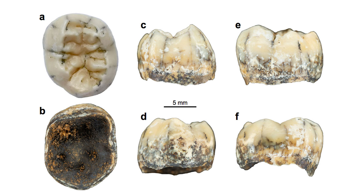 Denisovan tooth laos