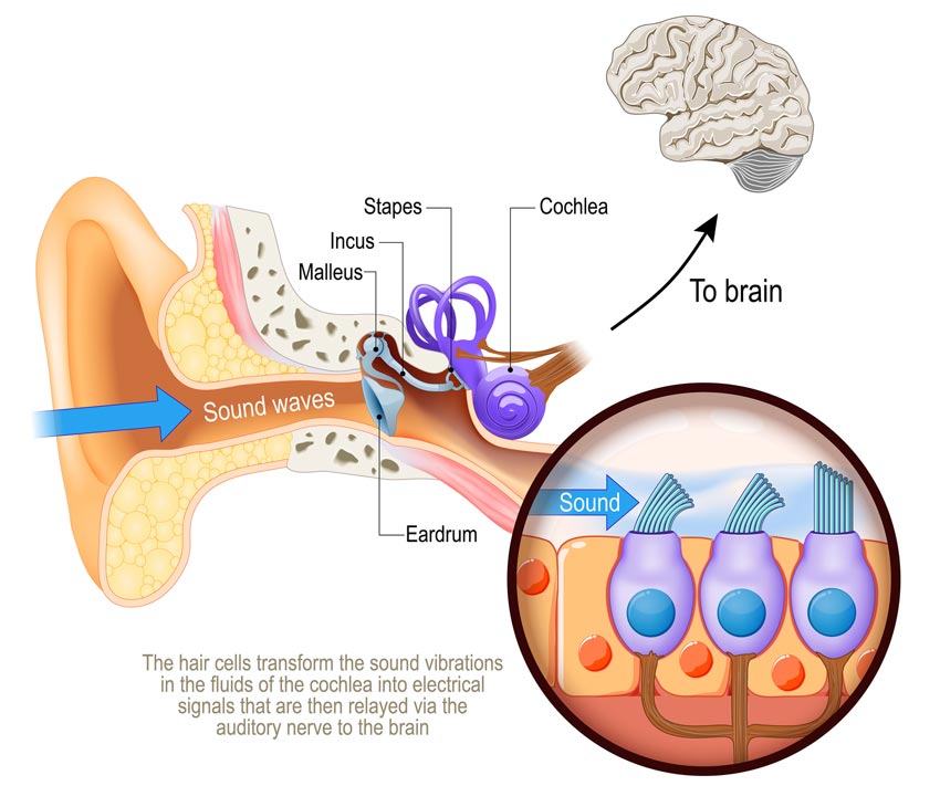 Reverse hearing loss concept scientific illustration showing the anatomy of the ear, starting with the external ear on the left, sound waves travelling through the ear drum to the tympanic membrane or ear drum and causing the ossicles (malleus, incus and stapes) to vibrate, then to the cochlea and to the brain. An inset figure shows sound reaching the hair cells in the cochlea supported by support cells. The legend reads "the hair cells transform the sound vibrations in the fluids of the cochlea into electrical signals that are then relayed via the auditory nerve to the brain"