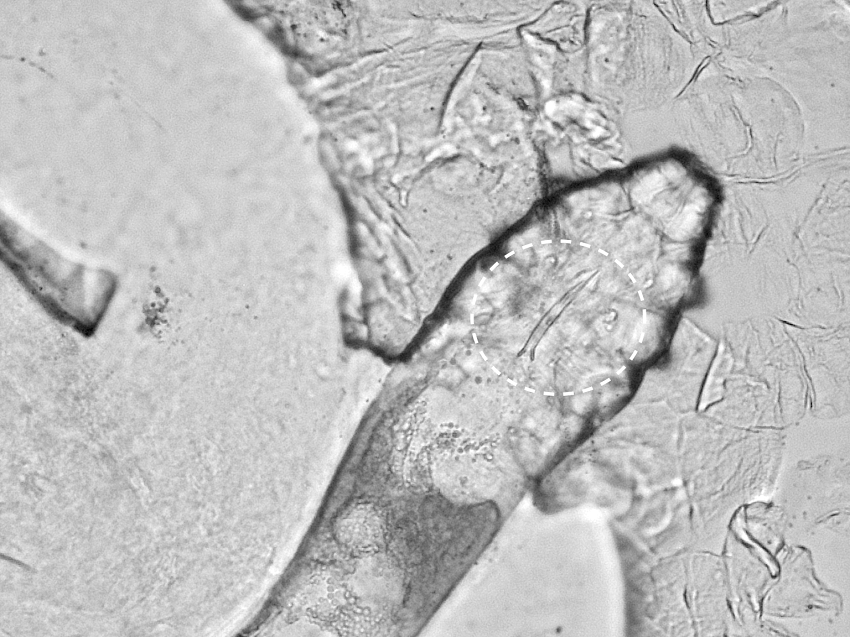 Microscope image showing the positioning of the mite penis