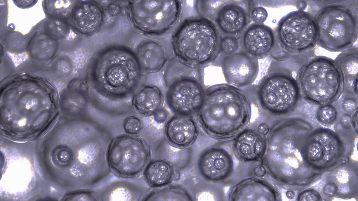 Close up of foam carbon monoxide bubbles
