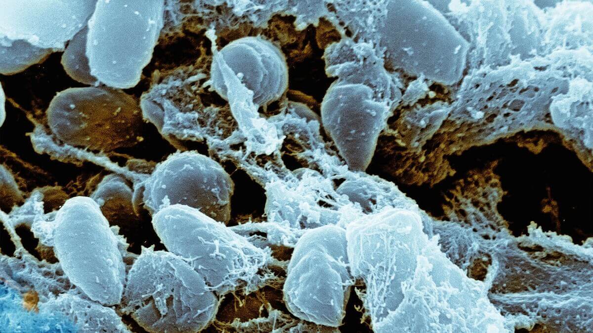 Scanning electron micrograph of Yersinia pestis, the bacteria that caused the Black Death.