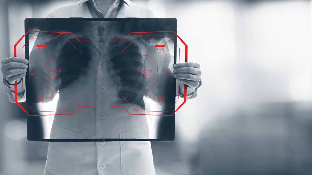 person holding up an X-ray with computer code on it, representing AI in medicine