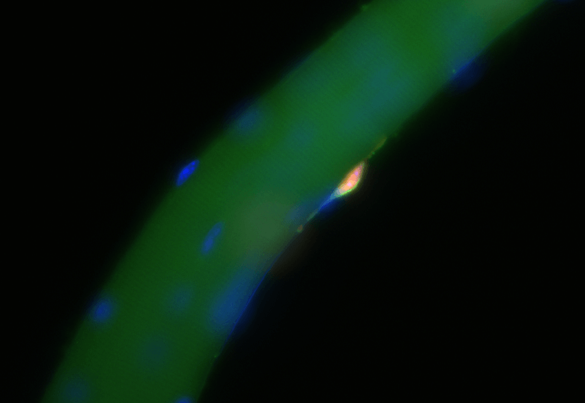 Muscle stem cell on a muscle fibre. Image by dr. Kiran nakka