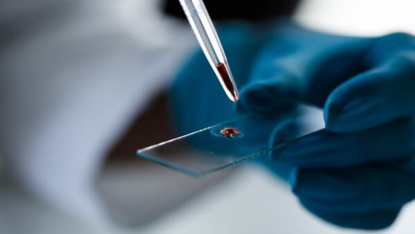 blood drop on microscope slide in lab
