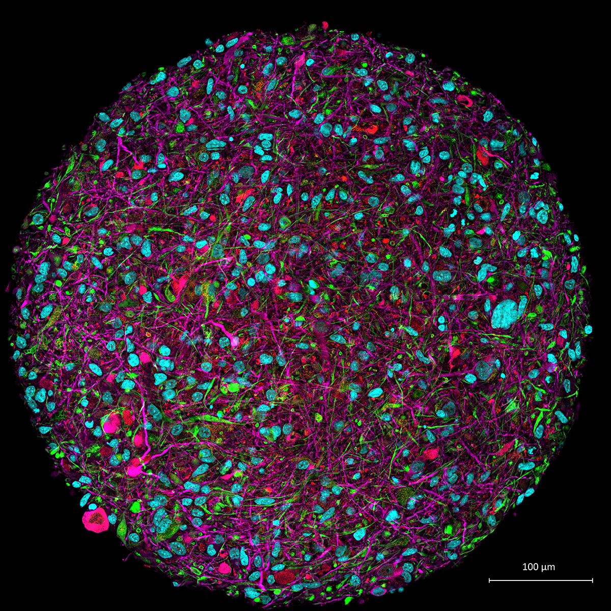 Brain organoid credit Thomas Hartung Johns Hopkins University min 1