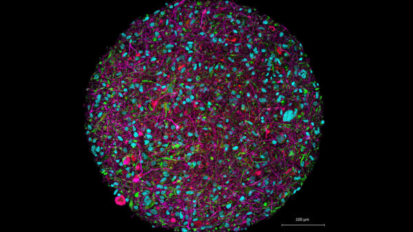 Brain organoid credit Thomas Hartung Johns Hopkins University min 2
