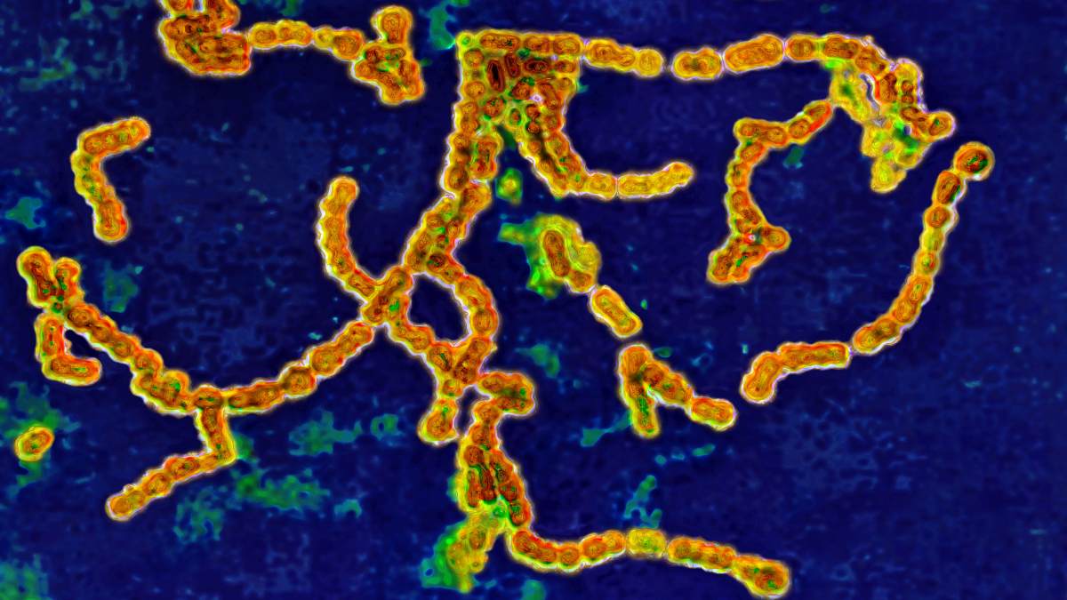 strep throat bacteria microscope