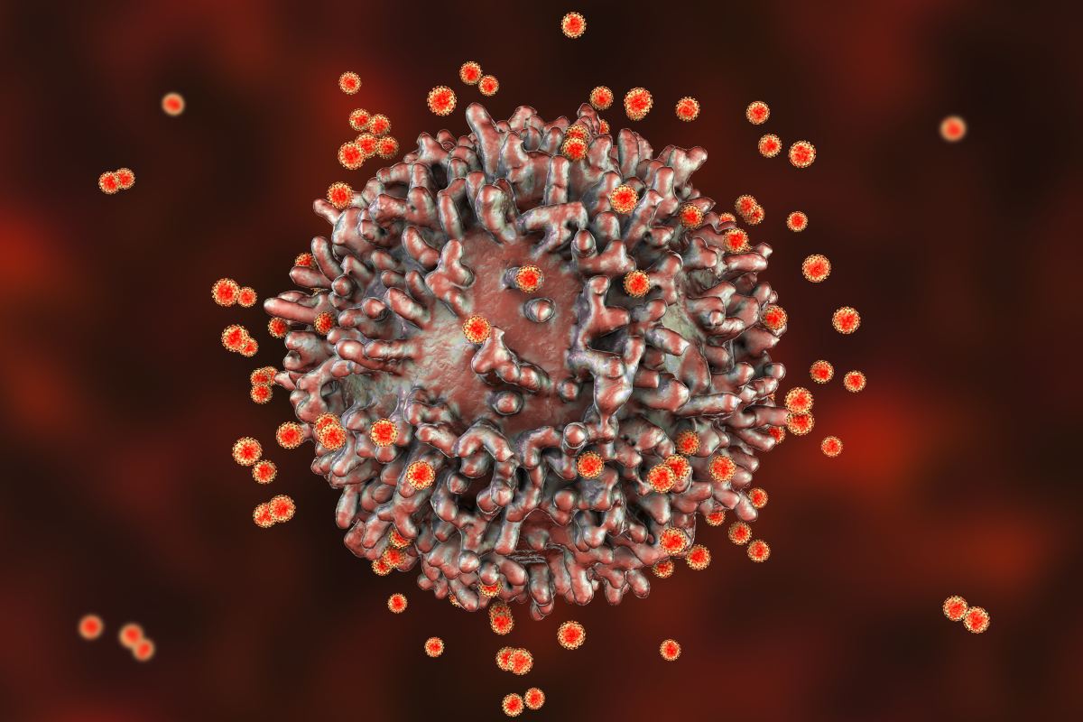 Het covid-virus muteerde bij een Nederlandse man, wat het belang van goede immuungecompromitteerde zorg benadrukt