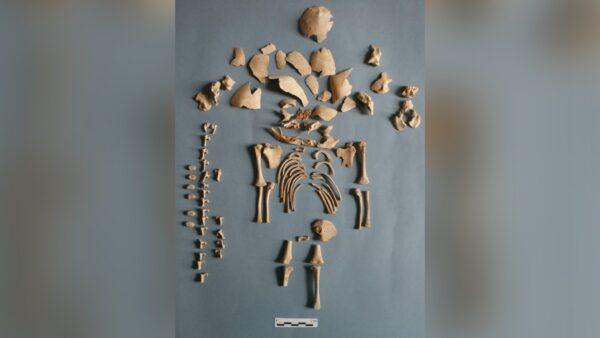 skeleton remains of ancient boy with down syndrome