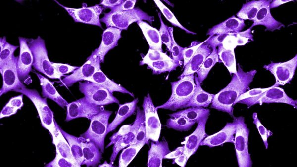 Microscope photograph of cells coloured purple, growing on a black background