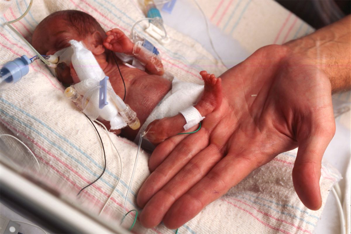 Stem cell hope on the horizon for preterm babies